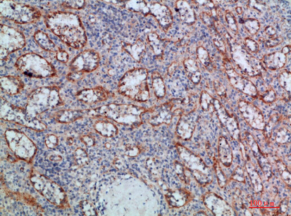 Rabbit Polyclonal Antibody to LTB