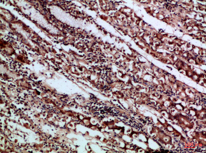 Rabbit Polyclonal Antibody to CD66a/b/c