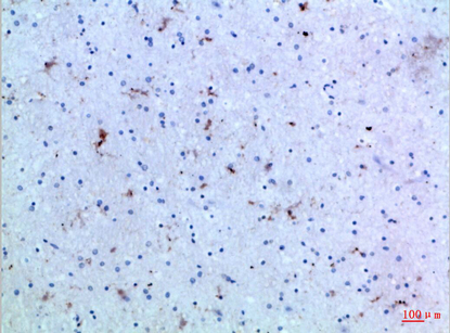 Rabbit Polyclonal Antibody to IL-15