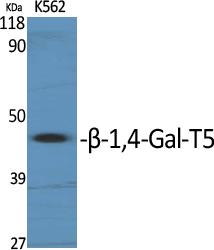 Rabbit Polyclonal Antibody to B4GALT5
