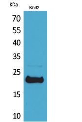 Rabbit Polyclonal Antibody to LIF