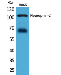 Rabbit Polyclonal Antibody to Neuropilin 2