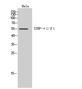 Rabbit Polyclonal Antibody to SIRP alpha/beta