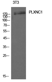 Rabbit Polyclonal Antibody to CD232