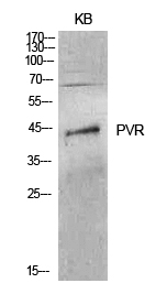 Rabbit Polyclonal Antibody to CD155