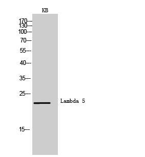 Rabbit Polyclonal Antibody to CD179b