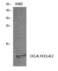 Rabbit Polyclonal Antibody to CCL4L