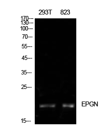 Rabbit Polyclonal Antibody to Epigen