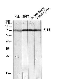 Rabbit Polyclonal Antibody to Factor XIII