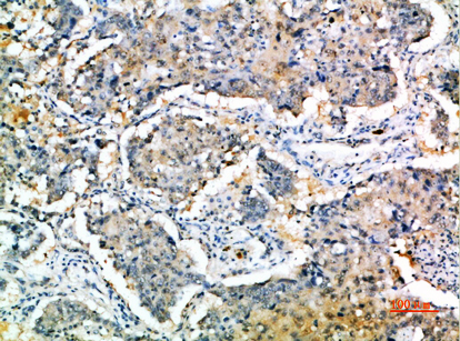 Rabbit Polyclonal Antibody to SOCS3