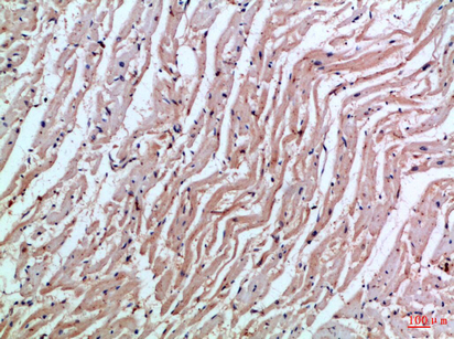 Rabbit Polyclonal Antibody to MIA