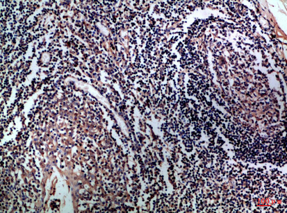 Rabbit Polyclonal Antibody to CD1a/b