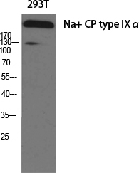 Rabbit Polyclonal Antibody to Nav1.7