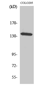 Rabbit Polyclonal Antibody to ALPK1