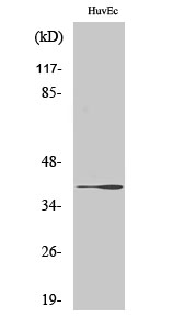 Rabbit Polyclonal Antibody to beta 3 Gal T1