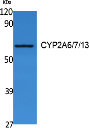 Rabbit Polyclonal Antibody to Cytochrome P450 2A6/7/13