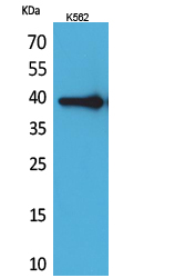 Rabbit Polyclonal Antibody to HspA6/A7