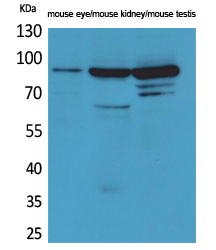 Rabbit Polyclonal Antibody to HGS