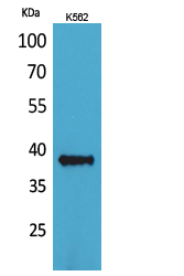 Rabbit Polyclonal Antibody to CD1C