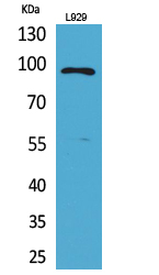 Rabbit Polyclonal Antibody to MACC1