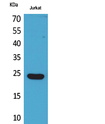 Rabbit Polyclonal Antibody to Interferon epsilon