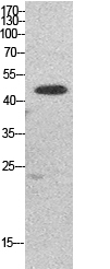 Rabbit Polyclonal Antibody to Elongation Factor 1A1/2/P5