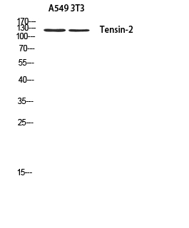 Rabbit Polyclonal Antibody to Tensin 2