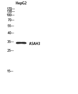 Rabbit Polyclonal Antibody to ASAH3