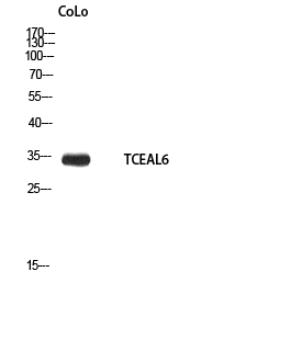 Rabbit Polyclonal Antibody to TCEAL6