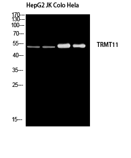 Rabbit Polyclonal Antibody to TRMT11