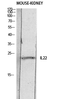 Rabbit Polyclonal Antibody to IL-22