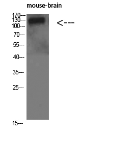 Rabbit Polyclonal Antibody to Collagen IV alpha 1