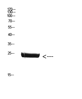 Rabbit Polyclonal Antibody to Placental Lactogen