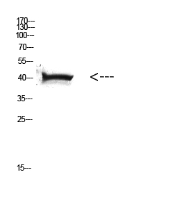 Rabbit Polyclonal Antibody to HLA A