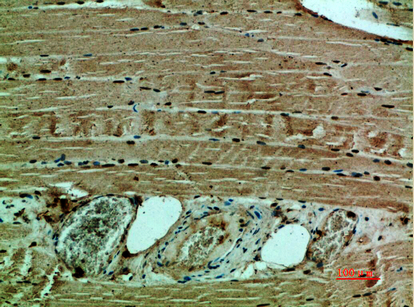 Rabbit Polyclonal Antibody to Collagen XII alpha 1