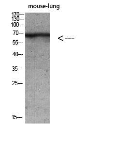 Rabbit Polyclonal Antibody to Cytokeratin