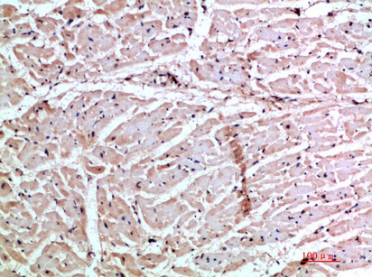Rabbit Polyclonal Antibody to GRO gamma