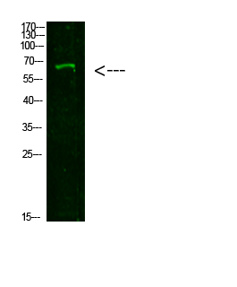 Rabbit Polyclonal Antibody to NUT