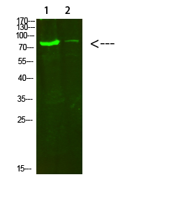 Rabbit Polyclonal Antibody to Collagen VIII alpha 2