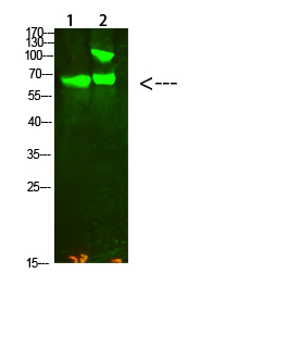 Rabbit Polyclonal Antibody to Collagen XIII alpha 1