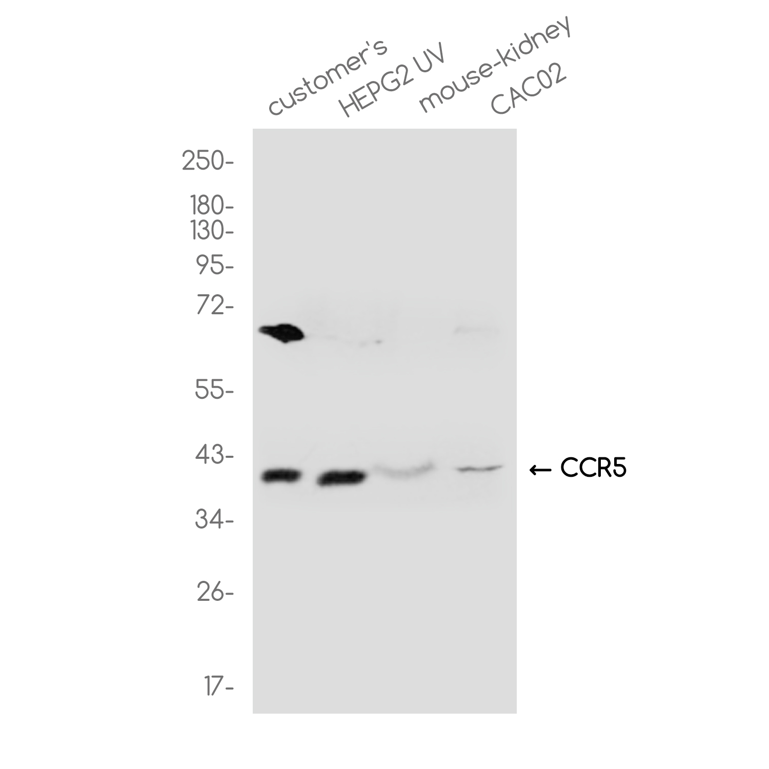 Rabbit Polyclonal Antibody to CCR5