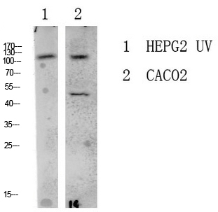 Rabbit Polyclonal Antibody to LATS1