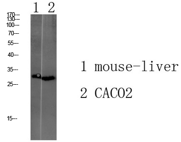 Rabbit Polyclonal Antibody to Transmembrane Protein 72