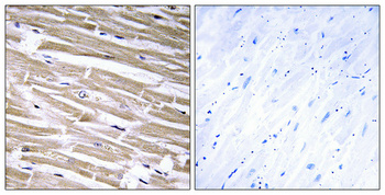 Rabbit Polyclonal Antibody to B3GALT2