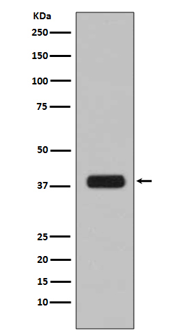 Rabbit Polyclonal Antibody to Aurora B