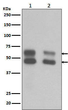 Rabbit Polyclonal Antibody to CaMKII