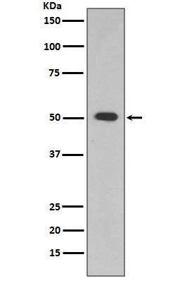 Rabbit Polyclonal Antibody to ALDH1A1