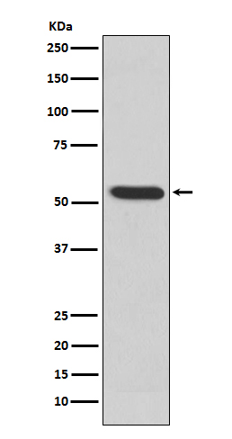 Rabbit Polyclonal Antibody to MMP3