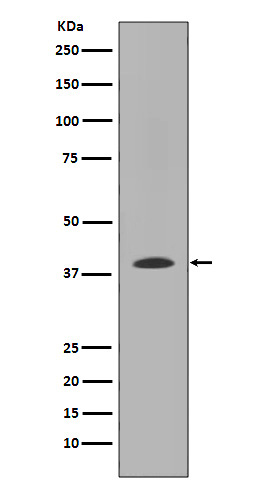 Rabbit Polyclonal Antibody to MMP12
