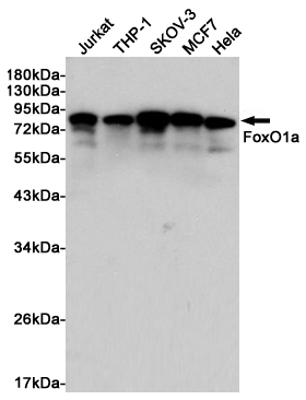 Rabbit Polyclonal Antibody to FOXO1